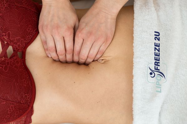 diastasis recti treatment Harpenden