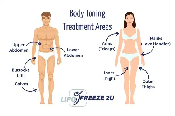 Graphic showing where you can have Body toning Treatment Harpenden on your body