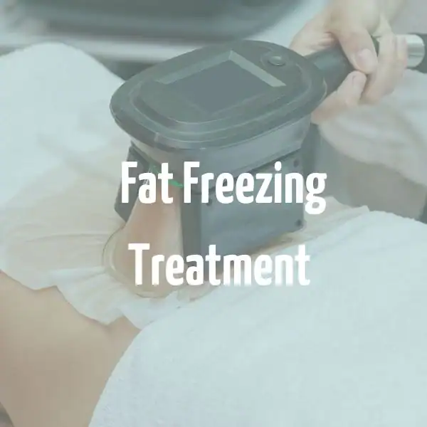 fat freezing treatment Harpenden