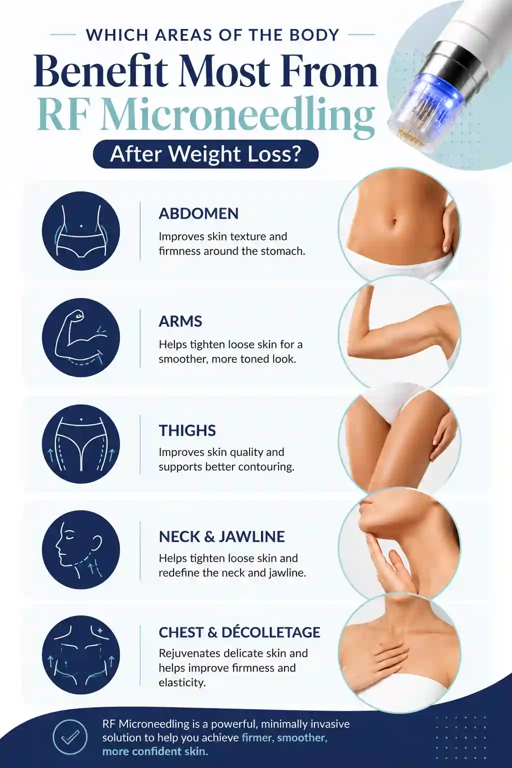 Which Areas of the Body Benefit Most From RF Microneedling After Weight Loss Harpenden